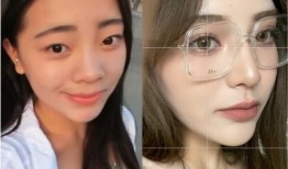 双眼皮手术恢复过程全记录，视频解析与详细指南