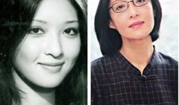 双眼皮手术后的效果，美丽蜕变与恢复过程