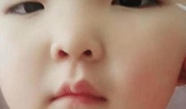 双眼皮手术的潜在危害及其预防措施