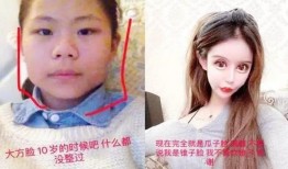 双眼皮手术的潜在危害及其预防措施