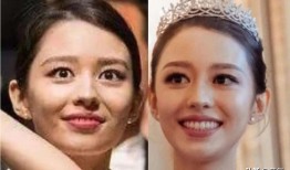 双眼皮手术后的效果，美丽蜕变与恢复过程