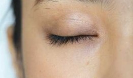 双眼皮手术后的后遗症，了解、预防与应对策略
