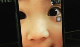 双眼皮手术，了解后遗症与视频教程指南